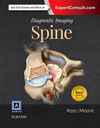 Diagnostic Imaging : Spine
