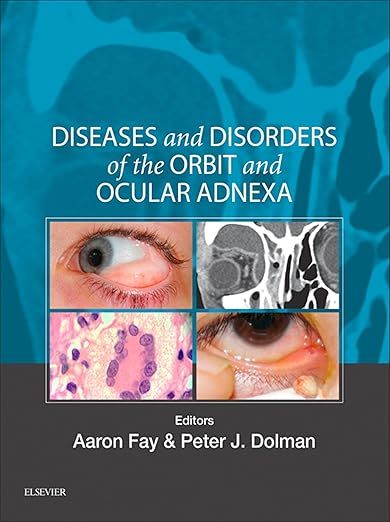 Diseases and Disorders of the Orbit and Ocular Adnexa E-Book: Expert Consult
