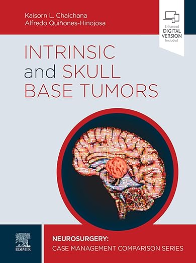 Intrinsic and Skull Base Tumors