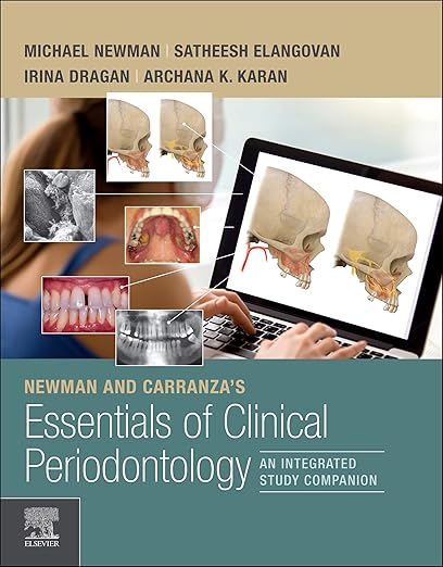 Newman and Carranza's Essentials of Clinical Periodontology