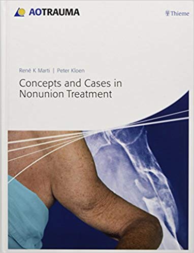 Concepts and Cases in Nonunion Treatment (AO Trauma Handbooks)-Original PDF