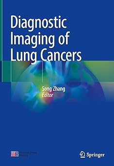 Diagnostic Imaging of Lung Cancers -EPUB