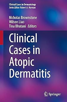 Clinical Cases in Atopic Dermatitis (Clinical Cases in Dermatology) -EPUB