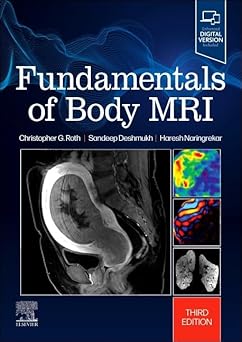 Fundamentals of Body MRI (Fundamentals of Radiology) 3rd Edition-EPUB