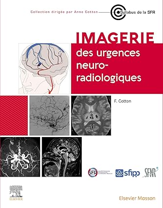 Imagerie des urgences neuroradiologiques (French Edition) -Original PDF