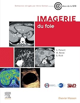 Imagerie du foie (French Edition) -Original PDF