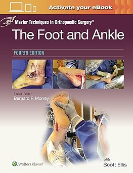 Master Techniques in Orthopaedic Surgery: The Foot and Ankle 4th edition-EPUB