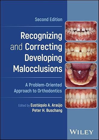 Recognizing and Correcting Developing Malocclusions: A Problem-Oriented Approach to Orthodontics 2nd Edition-Original PDF