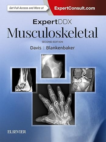ExpertDDx: Musculoskeletal 2nd Edition-EPUB