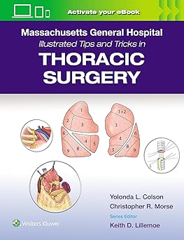 Massachusetts General Hospital Illustrated Tips and Tricks in Thoracic Surgery-EPUB