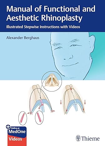 Manual of Functional and Aesthetic Rhinoplasty: Illustrated Stepwise Instructions with Videos -Original PDF