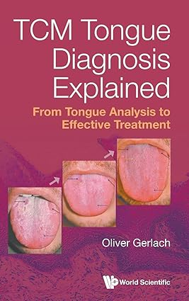 Tcm Tongue Diagnosis Explained: From Tongue Analysis To Effective Treatment -Original PDF