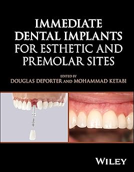 Immediate Dental Implants for Esthetic and Premolar Sites -Original PDF