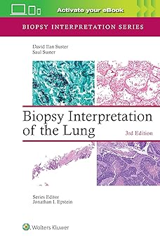 Biopsy Interpretation of the Lung(Biopsy Interpretation Series) 3rd Edition-EPUB
