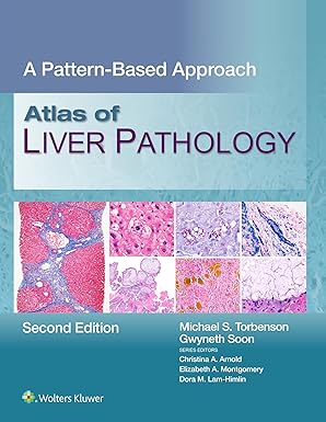 Atlas of Liver Pathology: A Pattern-Based Approach 2nd Edition-EPUB