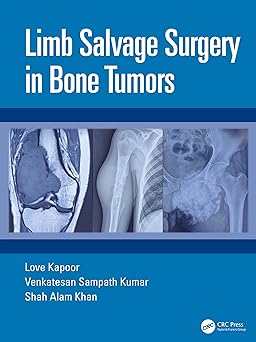 Limb Salvage Surgery in Bone Tumors 1st Edition-Original PDF