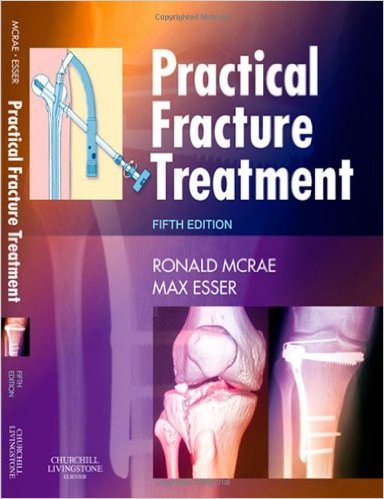Practical Fracture Treatment, 5e