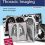 RadCases Plus Q&A Thoracic Imaging 2nd Edition-Original PDF