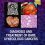 Diagnosis and Treatment of Rare Gynecologic Cancers-Original PDF