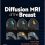 Diffusion MRI of the Breast 1st Edition-Original PDF