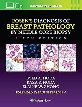 Rosen's Diagnosis of Breast Pathology by Needle Core Biopsy 5th Edition-EPUB