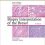 Biopsy Interpretation of the Breast (Biopsy Interpretation Series) Third edition-EPUB