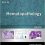 Hematopathology: A Volume in the Series: Foundations in Diagnostic Pathology, 3e-Original PDF
