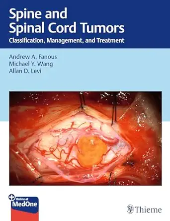 Spine and Spinal Cord Tumors - Classification, Management and Treatment