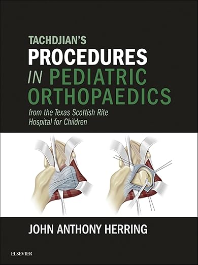 Tachdjian's Procedures in Pediatric Orthopaedics