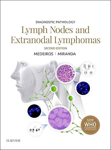 Lymph Nodes and Spleen with Extranodal Lymphomas