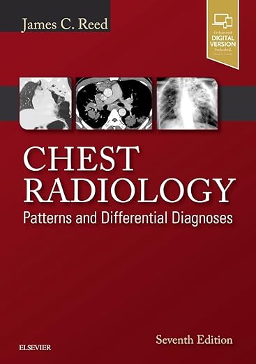 Chest Radiology: Patterns and Differential Diagnoses