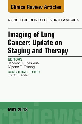 Lung Cancer, an Issue of Radiologic Clinics of North America