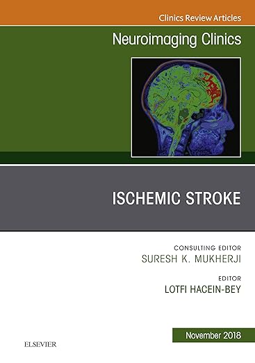 Ischemic Stroke, an Issue of Neuroimaging Clinics of North America
