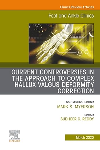 Controversies in the Approach to Complex Hallux Valgus Deformity Correction, An issue of Foot and Ankle Clinics of North America