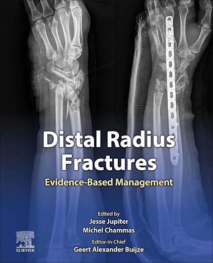 Distal Radius Fractures: Evidence-Based Management