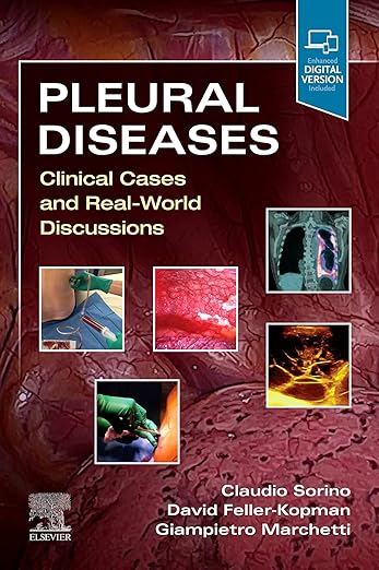Pleural Diseases
