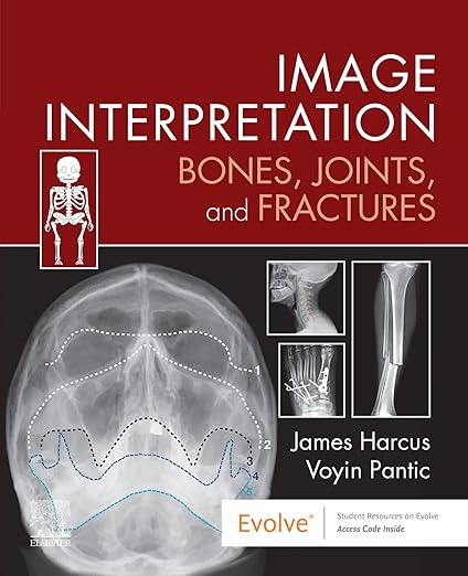 Image Interpretation