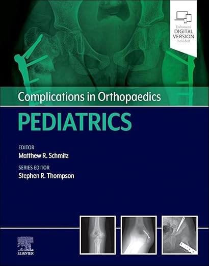 Complications in Orthopaedics