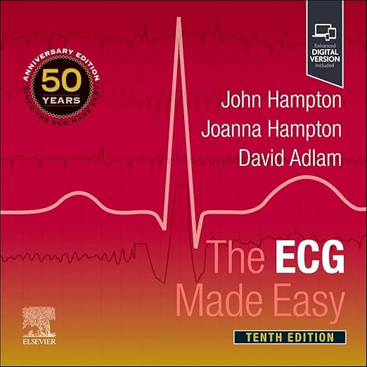ECG Made Easy
