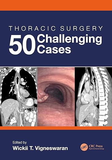 Thoracic Surgery