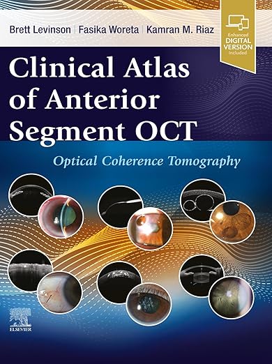 Clinical Atlas of Anterior Segment OCT
