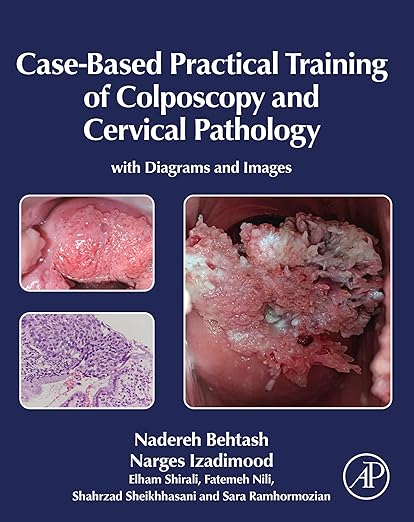 Case-Based Practical Training of Colposcopy and Cervical Pathology: With Diagrams and Images
