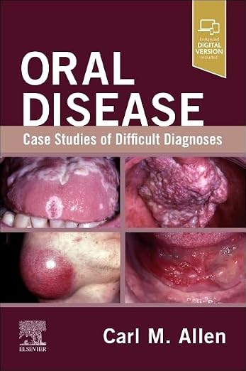 Oral Disease: Case Studies of Difficult Diagnoses: Case Studies of Difficult Diagnoses