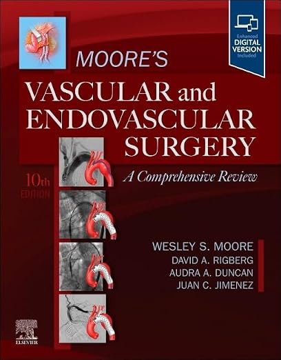 Moore's Vascular and Endovascular Surgery: A Comprehensive R