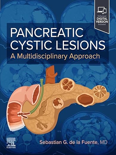 Pancreatic Cystic Lesions: A Multidisciplinary Approach - E-