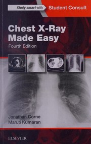 Chest X-Ray Made Easy