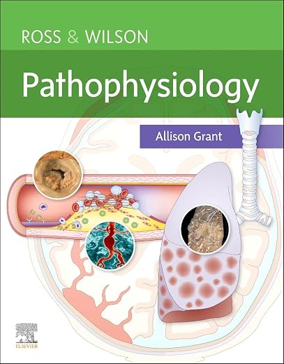 Ross and Wilson Pathophysiology