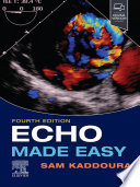 Echo Made Easy , E-Book
