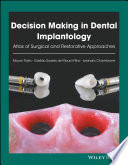 Decision Making in Dental Implantology
