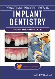Practical Procedures in Implant Dentistry
